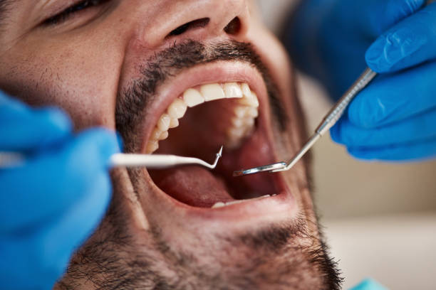 Best Emergency Tooth Extraction in Powell, WY
